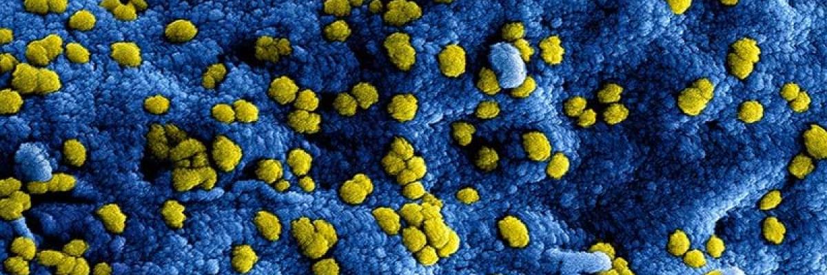 coronavirus